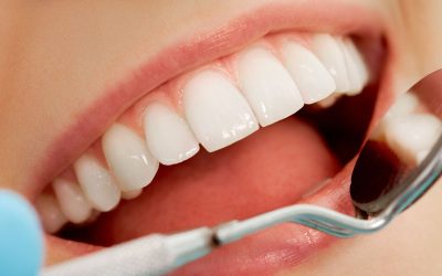 ¿Qué hace nuestro higienista dental?